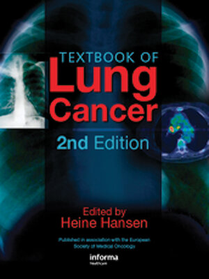 cover image of Textbook of Lung Cancer